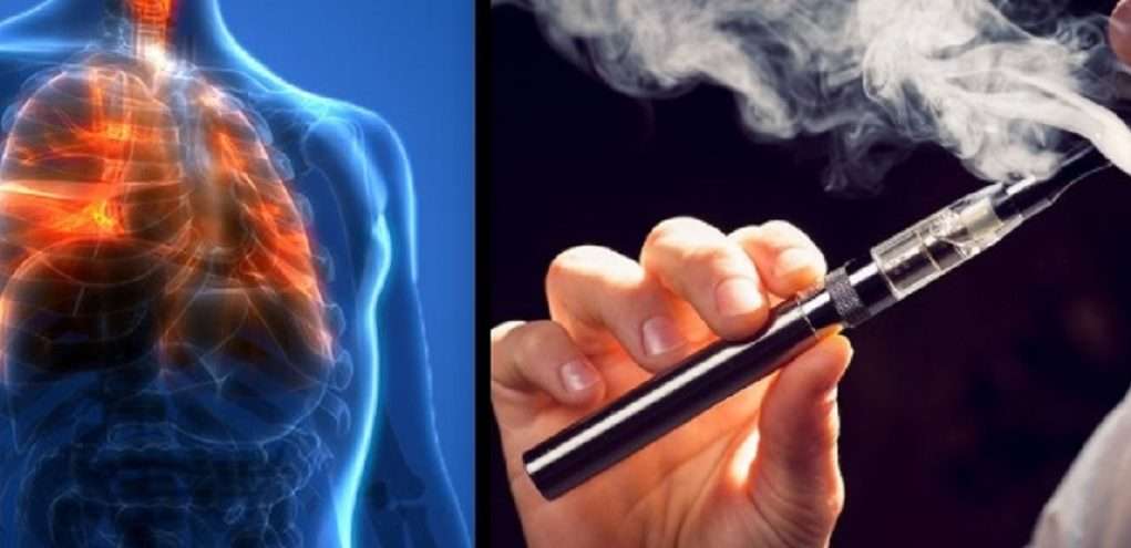 CDC Announces Vitamin E Acetate May Be the Cause behind Vaping Related ...