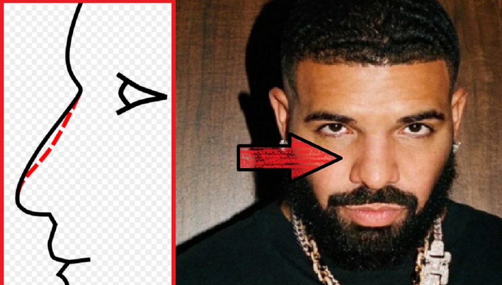 Did Drake Get a Nose Job Plastic Surgery? - JordanThrilla