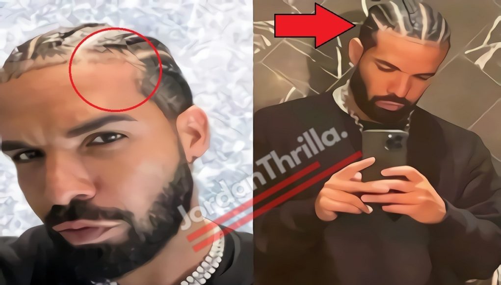 Is Drake Wearing Hair Weave Braids? Evidence Inside